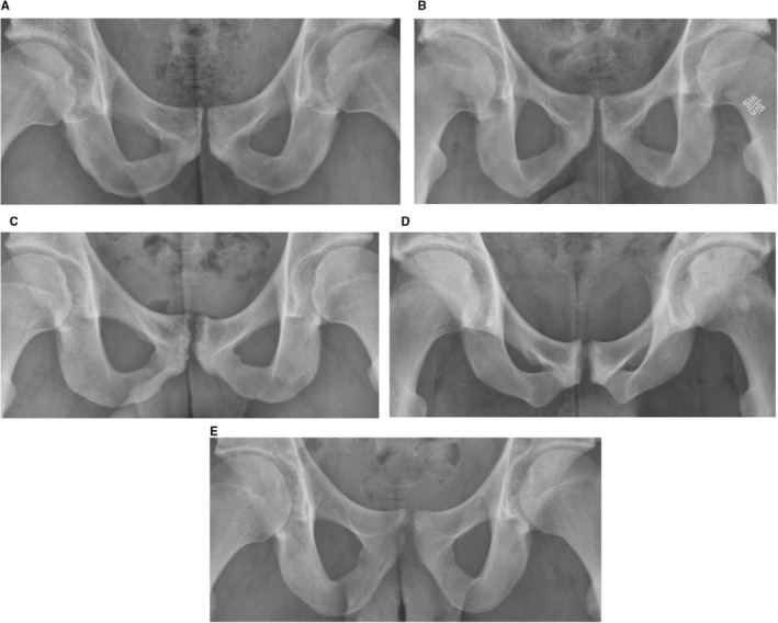 FIGURE 4