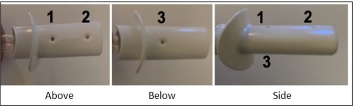 FIGURE 1