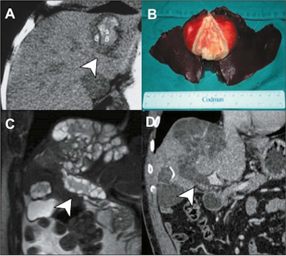 Figure 14