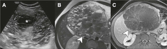 Figure 17