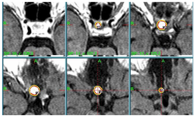 Figure 6