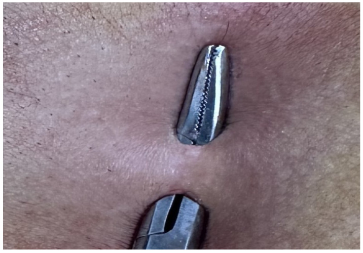 Figure 8