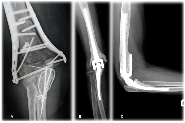 Figure 10