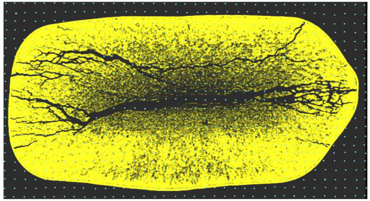 Figure 11
