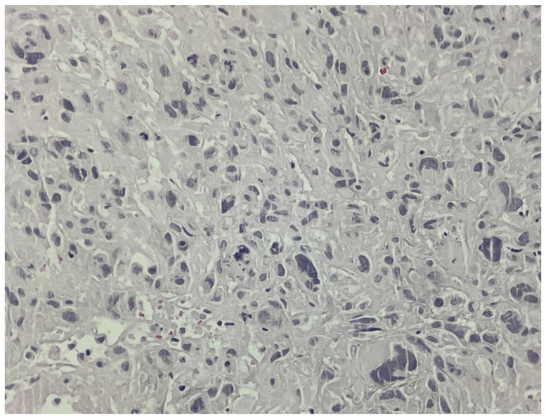 Figure 10