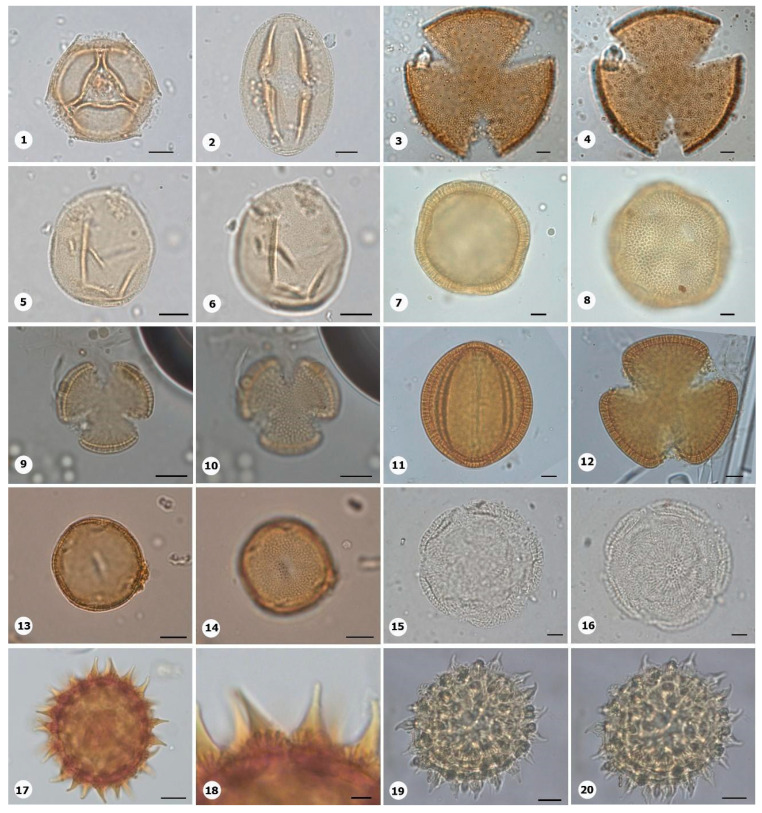 Figure 11