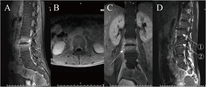 FIGURE 1