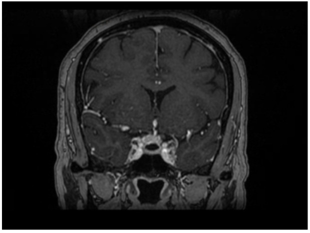 Figure 2