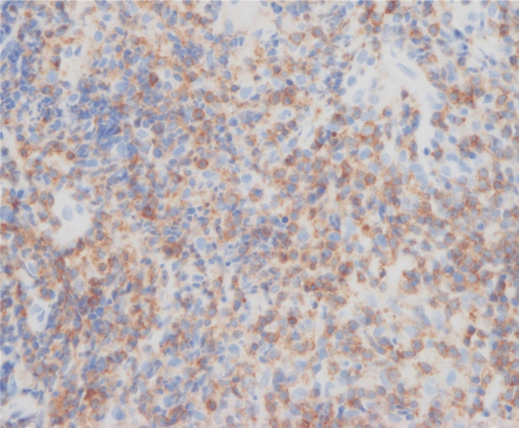 Figure 12