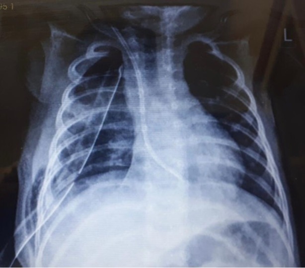 FIGURE 2