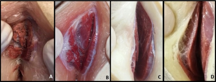 FIGURE 4
