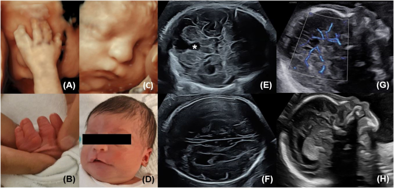 Figure 1