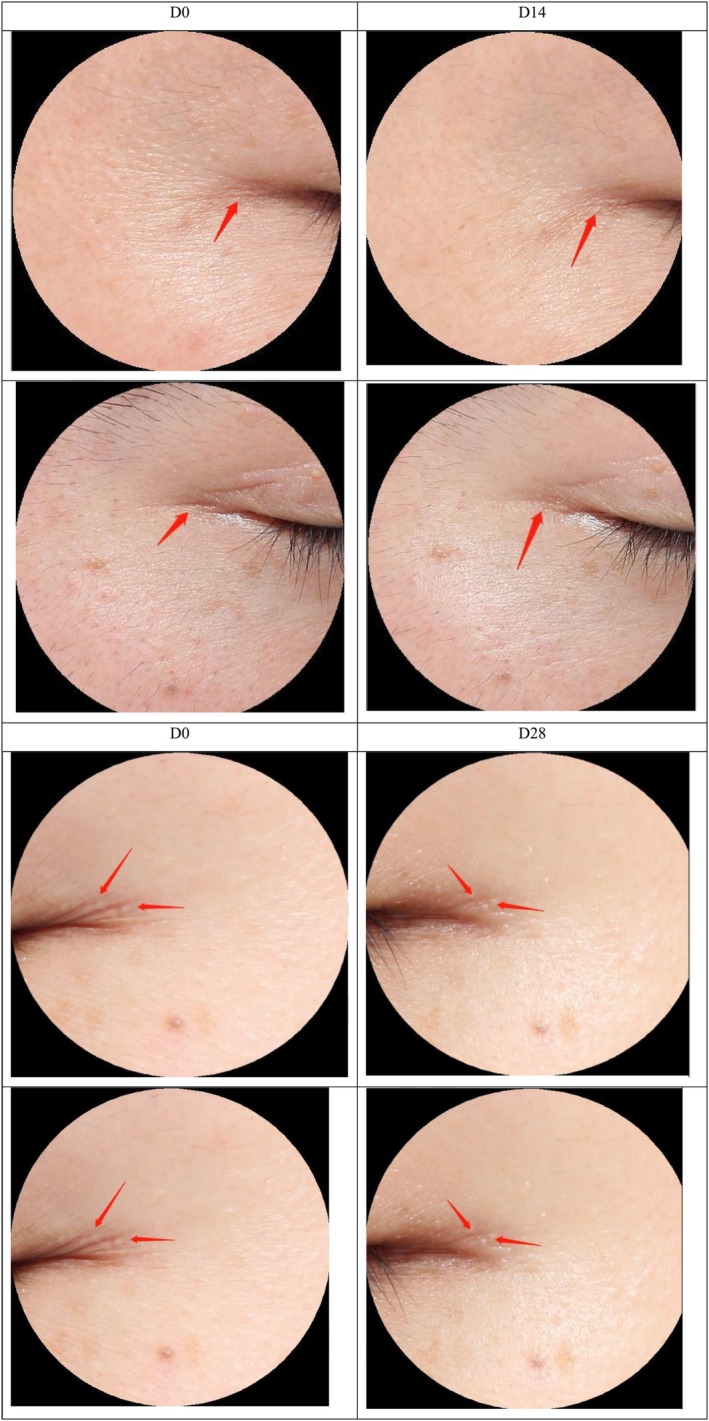 FIGURE 11