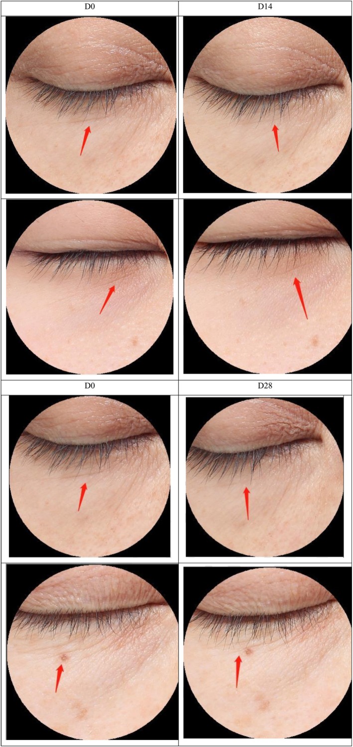 FIGURE 13