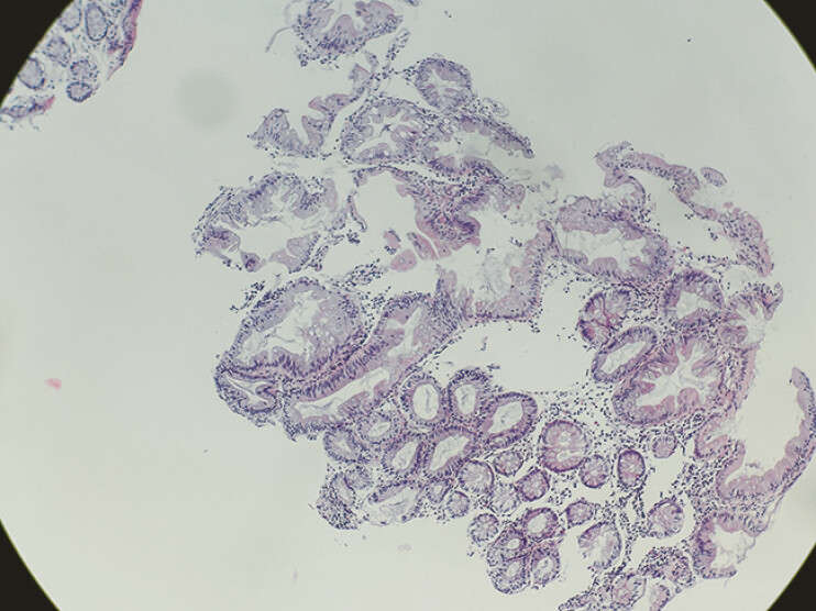 Fig. 4
