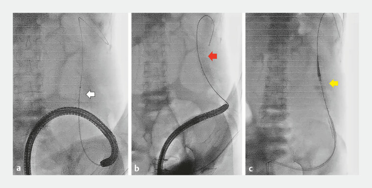 Fig. 5