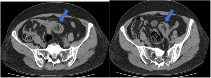 Figure 2