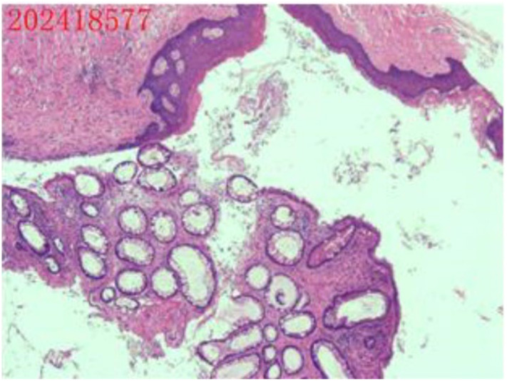 Figure 5