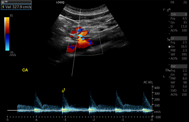 Figure 2