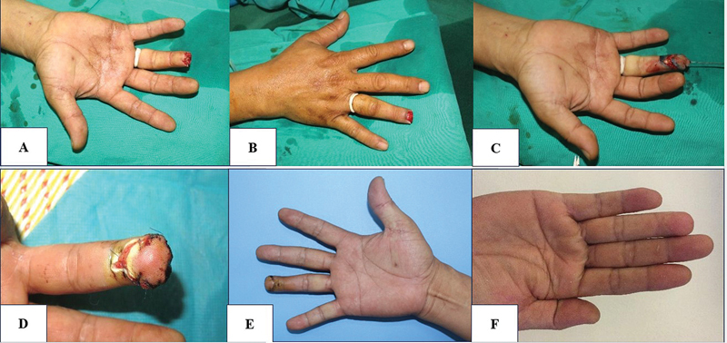 Fig. 4