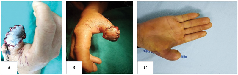 Fig. 6