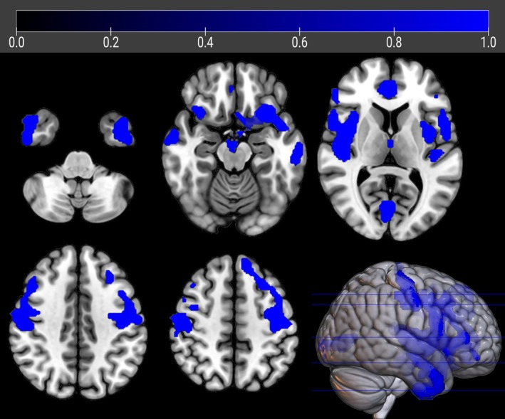 FIGURE 1