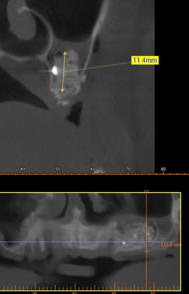 Figure 10