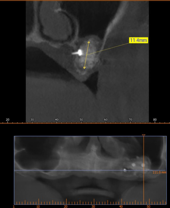 Figure 11