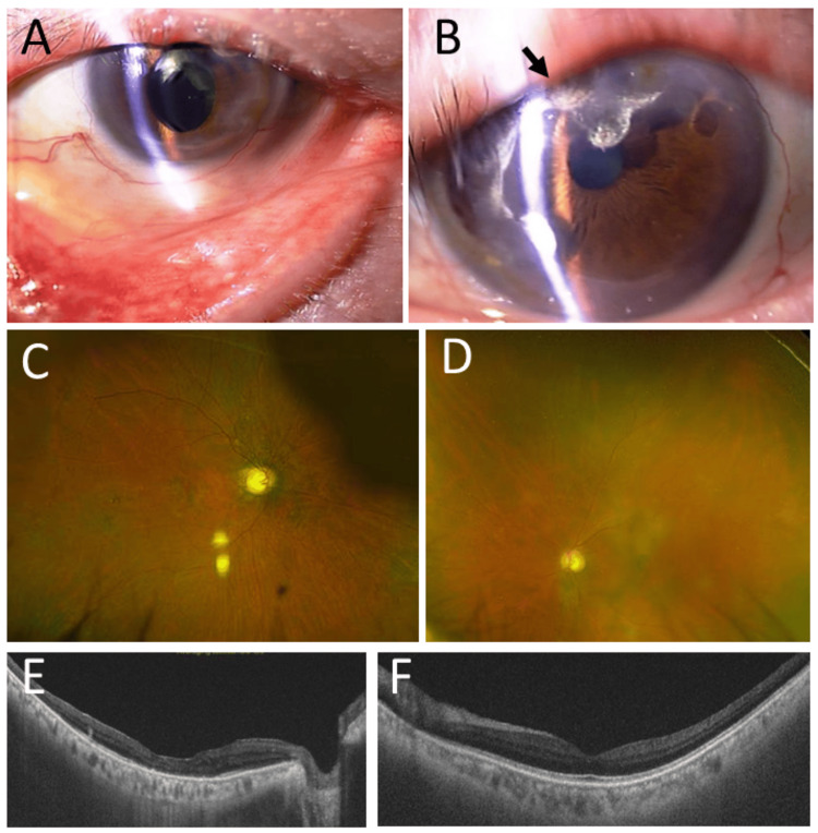 Figure 6