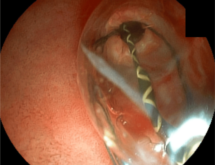 Figure 9