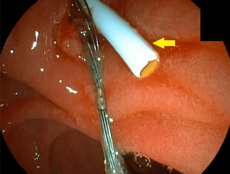 Figure 10