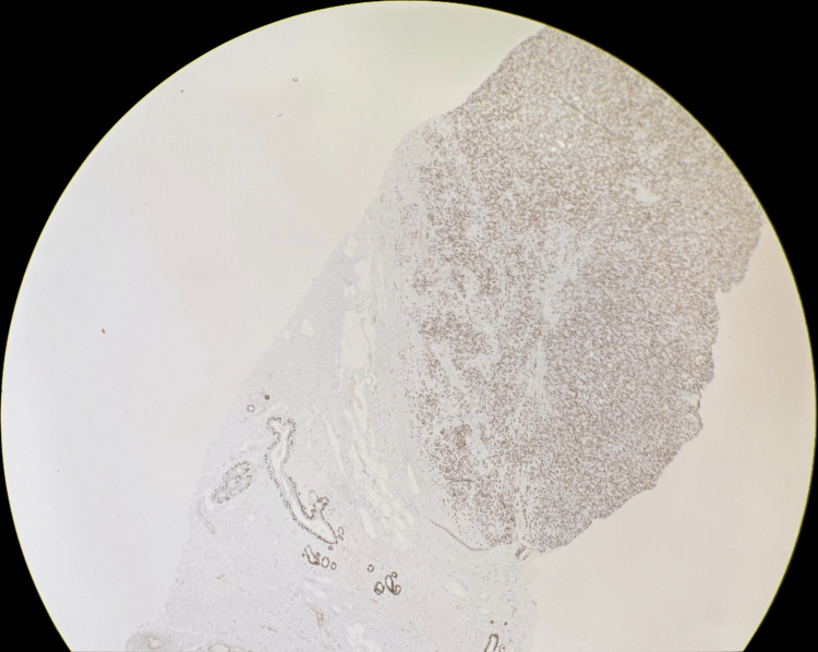 Figure 10