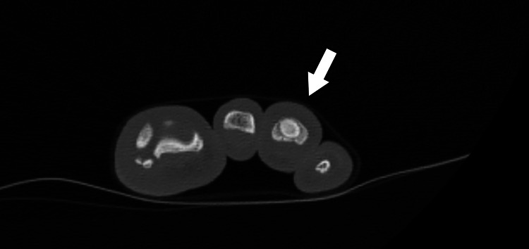 Figure 9