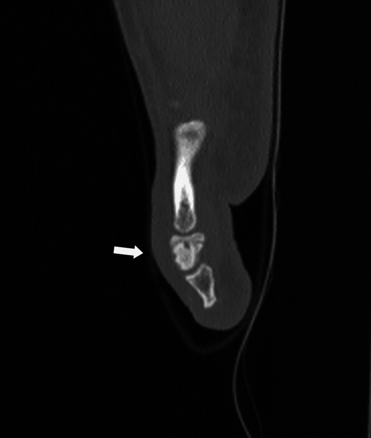 Figure 10