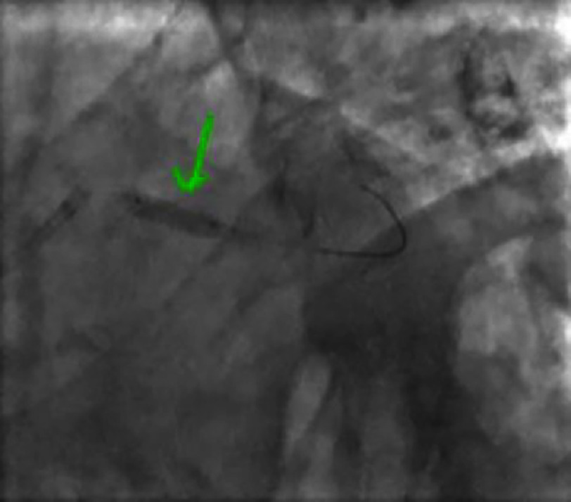 Figure 9