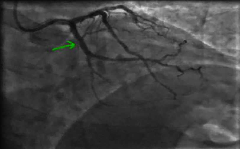 Figure 12