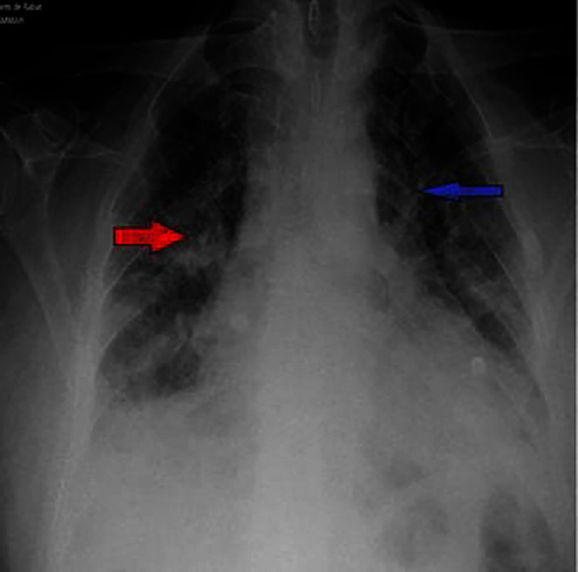 Figure 13