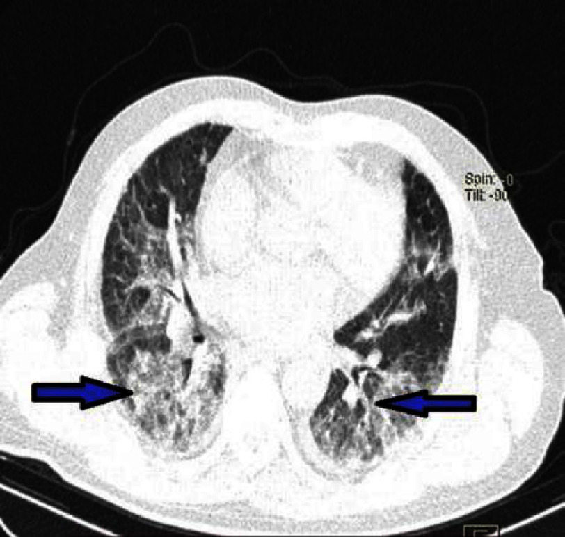 Figure 15