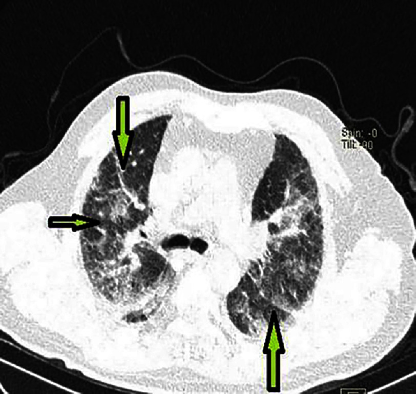 Figure 16