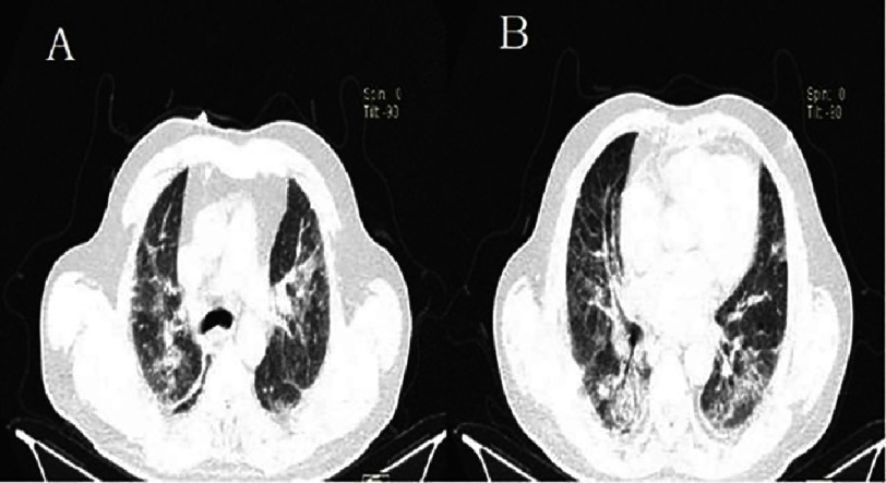 Figure 17