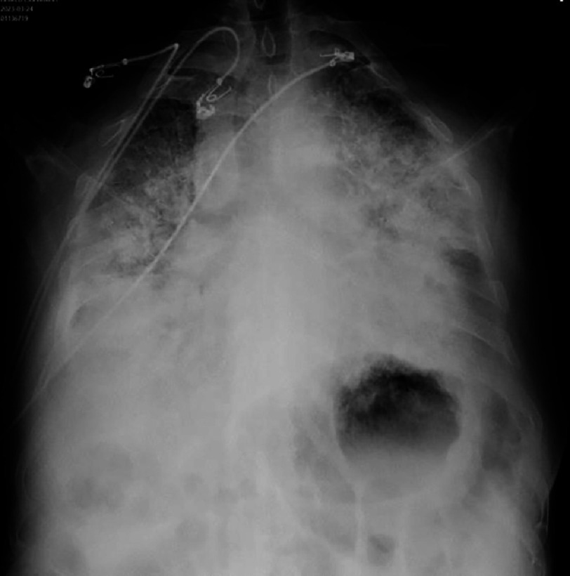 Figure 18