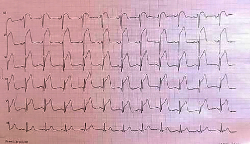 Figure 19
