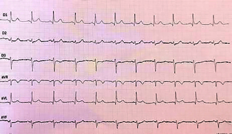 Figure 20