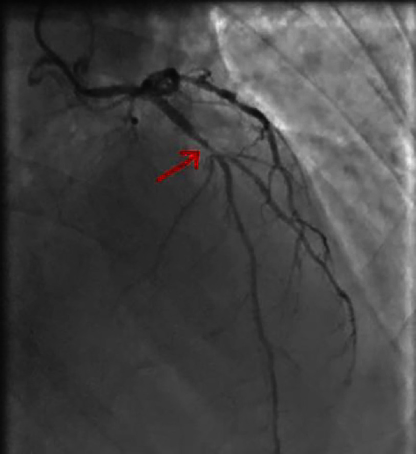 Figure 21