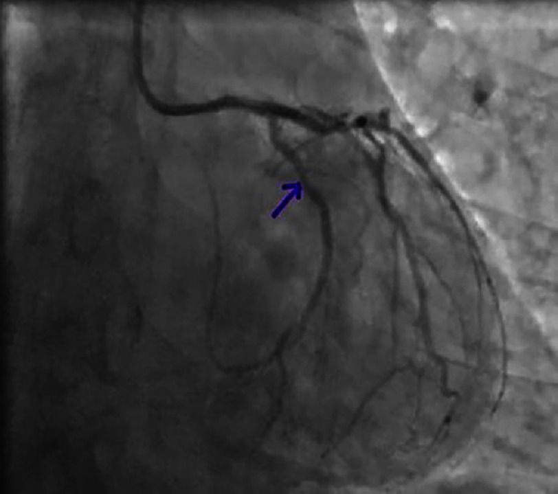 Figure 22