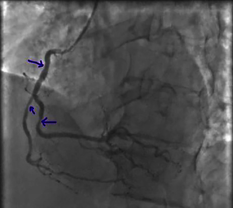 Figure 23