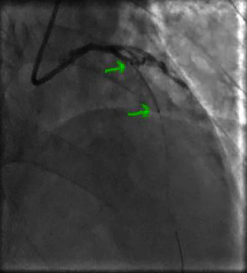 Figure 25