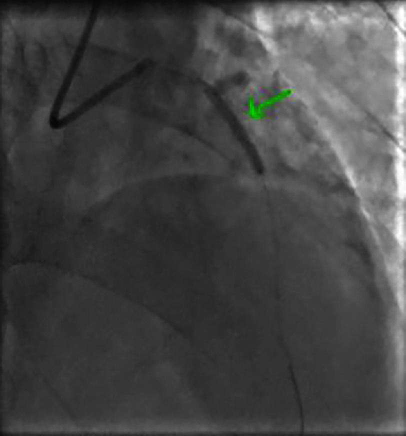 Figure 26