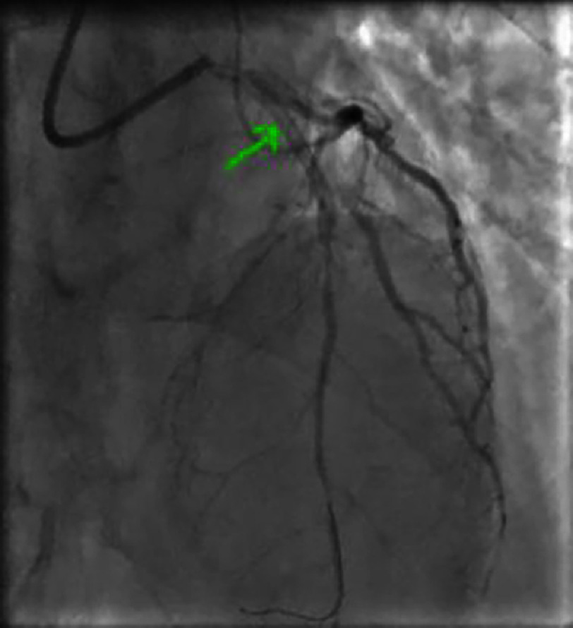 Figure 27