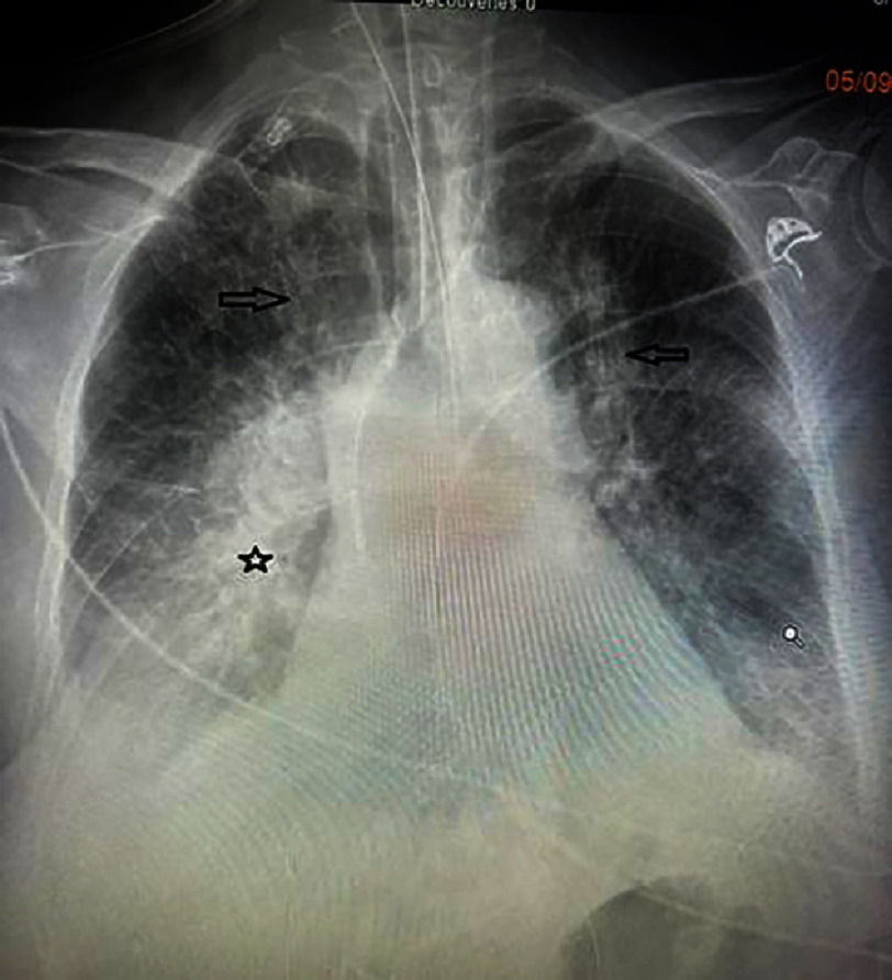 Figure 28